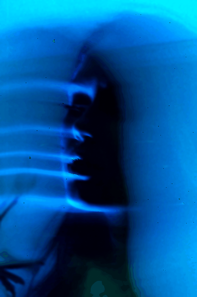 Distinguer le sain de l’infirme